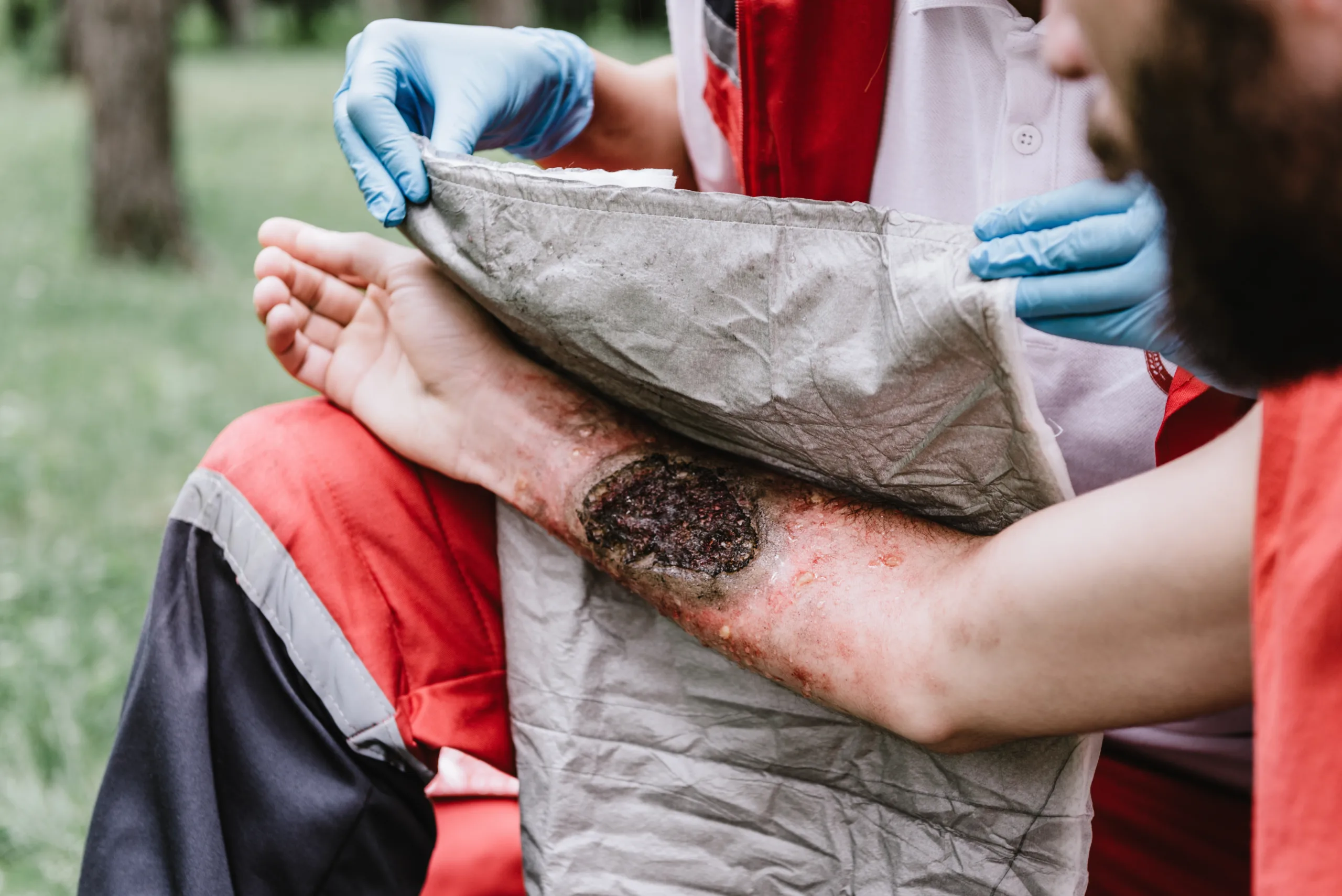 First aid paramedic in training, treating necrosis from krokodil
